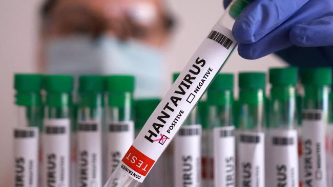 Bukan Penyakit Baru, Hantavirus Sudah Ada di RI Sejak 1991